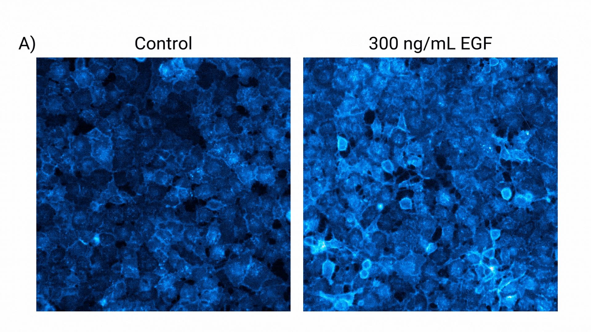 egfr-gif