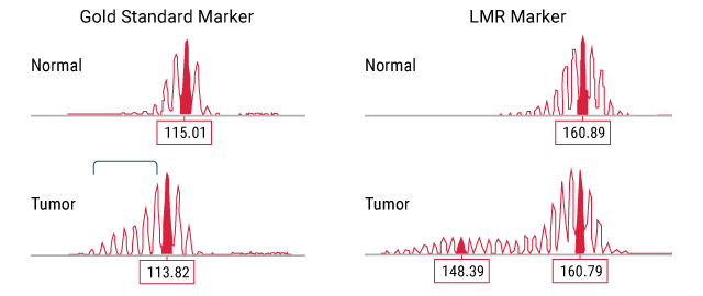 Tumor and normal endometrial cancer samples analyzed using the LMR MSI Analysis System